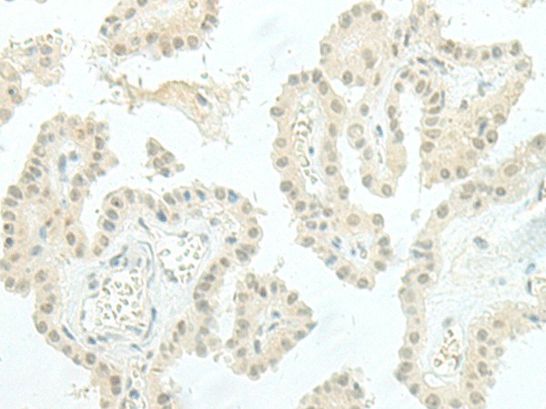 ESRP2 Polyclonal Antibody (E-AB-19822)