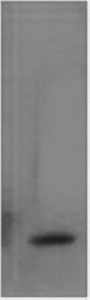 TNF alpha Monoclonal Antibody (E-AB-22159)