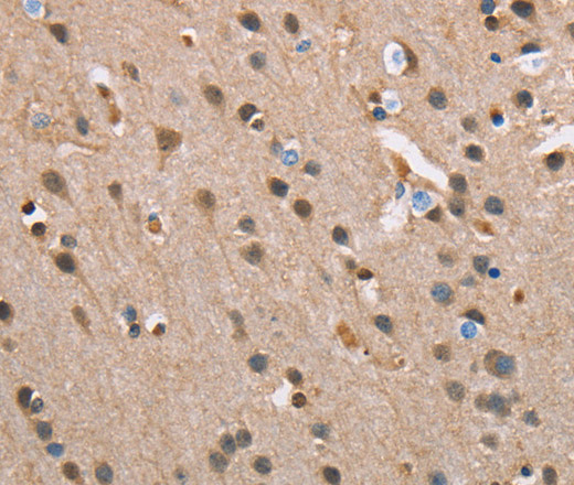 SERPINA1 Polyclonal Antibody (E-AB-10778)