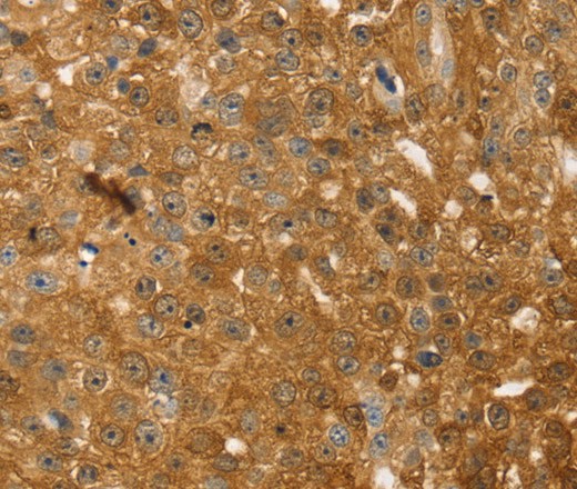TMSB10 Polyclonal Antibody (E-AB-16900)