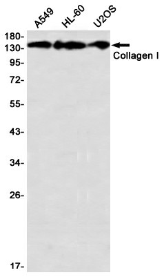 Recombinant Collagen I alpha 1 Monoclonal Antibody (E-AB-81499)