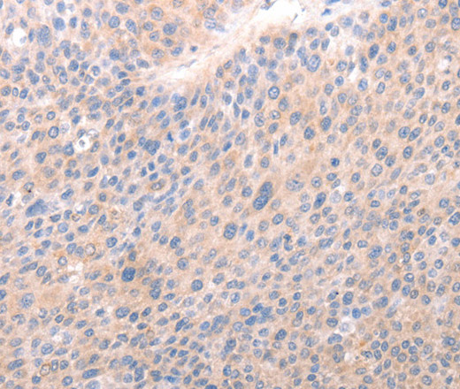 ACO1 Polyclonal Antibody (E-AB-12938)