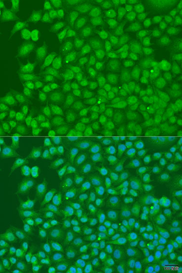 BIRC3 Polyclonal Antibody (E-AB-65709)
