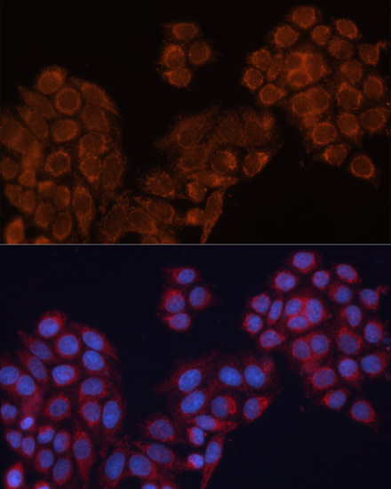 ALDH6A1 Polyclonal Antibody (E-AB-62126)