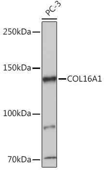 COL16A1 Polyclonal Antibody (E-AB-92131)