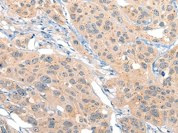 MIIP Polyclonal Antibody (E-AB-19754)