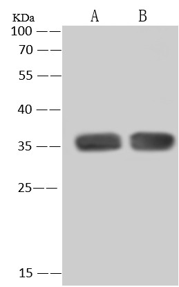 Recombinant PCNA Monoclonal Antibody (AN300417P)
