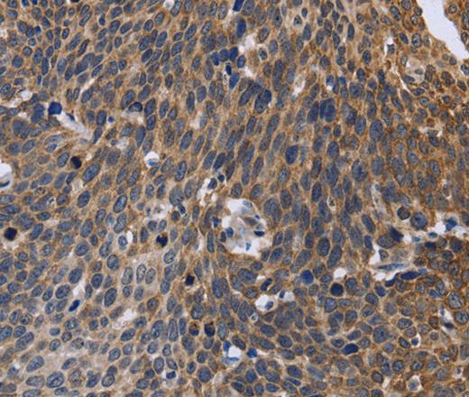 GABPB2 Polyclonal Antibody (E-AB-15053)