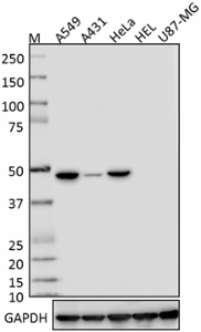Purified anti-Cytokeratin 18 Antibody