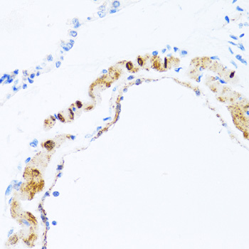 PHPT1 Polyclonal Antibody (E-AB-60198)