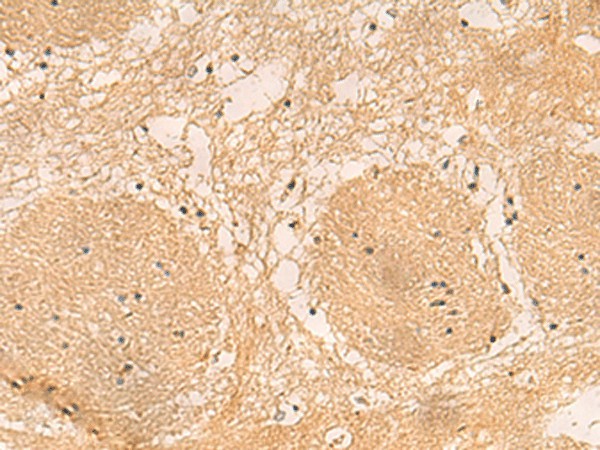 EMC1 Polyclonal Antibody (E-AB-18877)
