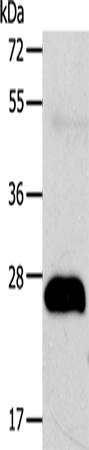 AGPAT2 Polyclonal Antibody (E-AB-12702)