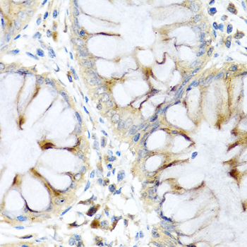 PI3 Polyclonal Antibody (E-AB-62869)
