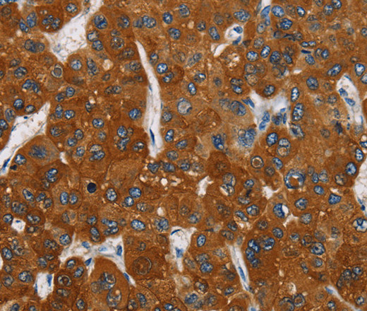 CARD9 Polyclonal Antibody (E-AB-11032)
