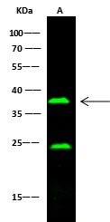 Recombinant CD16/FCGR3 Monoclonal Antibody (AN300509P)