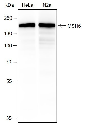Recombinant MSH6 Monoclonal Antibody (AN301605L)