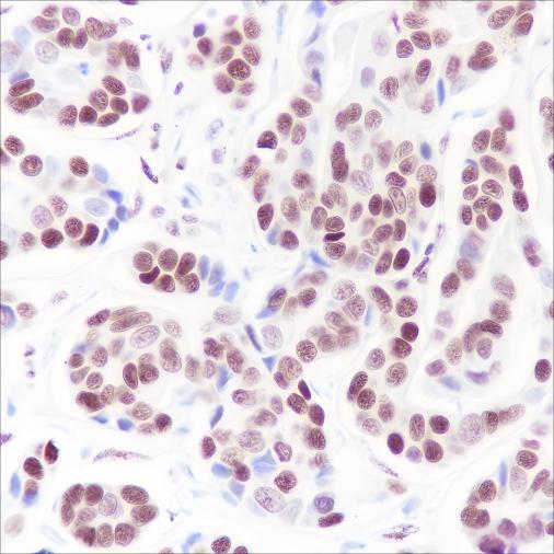 Recombinant SETD1A Monoclonal Antibody (AN301557L)