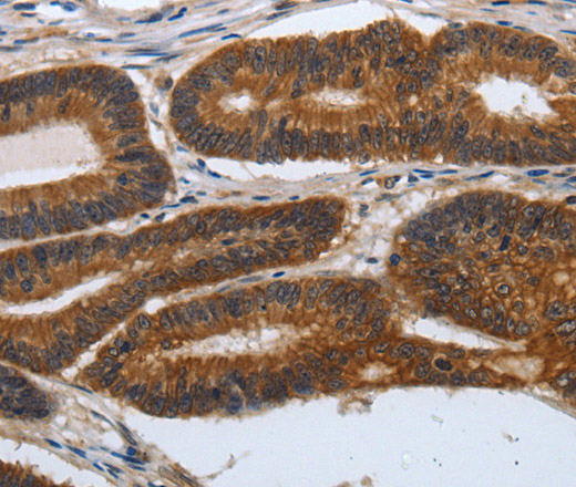PDCD7 Polyclonal Antibody (E-AB-12835)