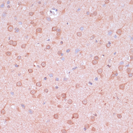 TIMM8B Polyclonal Antibody (E-AB-66589)