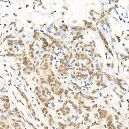 RGS2 Polyclonal Antibody (E-AB-91962)