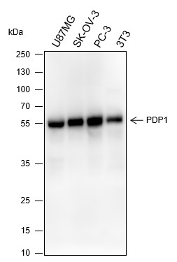 Recombinant PDP1 Monoclonal Antibody (AN301624L)