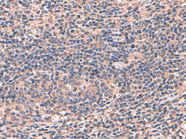 AHCYL1 Polyclonal Antibody (E-AB-19067)