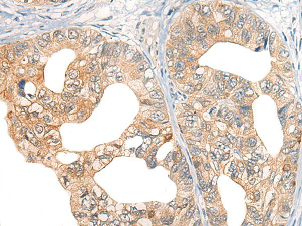 CORO2A Polyclonal Antibody (E-AB-17844)