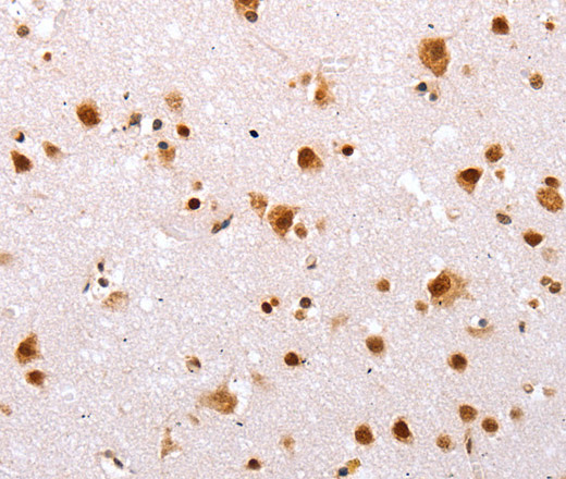 TBX2 Polyclonal Antibody (E-AB-12431)
