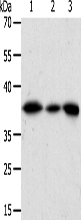 AKR1A1 Polyclonal Antibody (E-AB-12708)