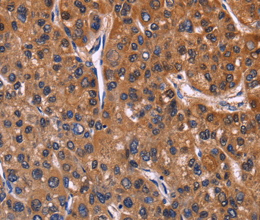 NFATC3 Polyclonal Antibody (E-AB-14243)