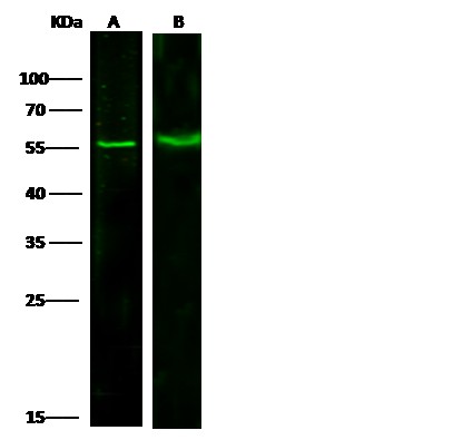PRMT6/HRMT1L6 Monoclonal Antibody (AN200075P)