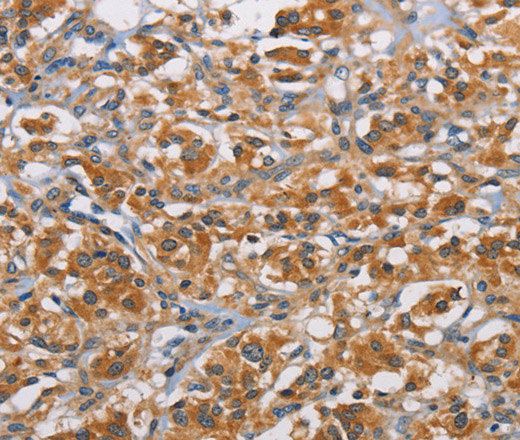 RICTOR Polyclonal Antibody (E-AB-14684)