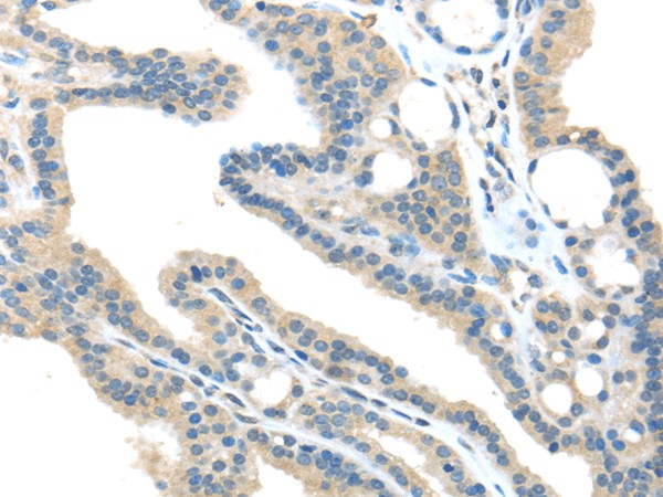 VPS36 Polyclonal Antibody (E-AB-17560)