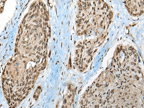 CCDC12 Polyclonal Antibody (E-AB-52522)