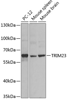 TRIM23 Polyclonal Antibody (E-AB-62007)