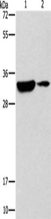 DSCR1 Polyclonal Antibody (E-AB-16188)