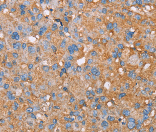 PAGE5 Polyclonal Antibody (E-AB-15279)