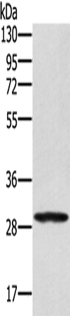 EDA2R Polyclonal Antibody (E-AB-14973)