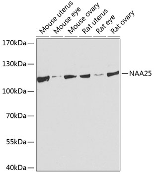 NAA25 Polyclonal Antibody (E-AB-62529)