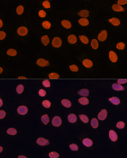 TADA3 Polyclonal Antibody (E-AB-67739)