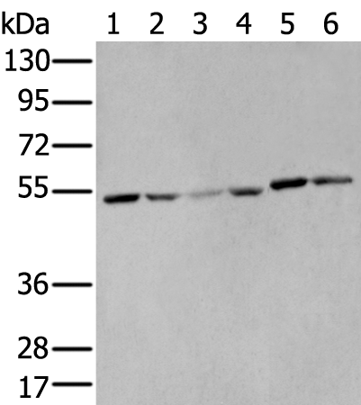 MMP1 Polyclonal Antibody (E-AB-13831)