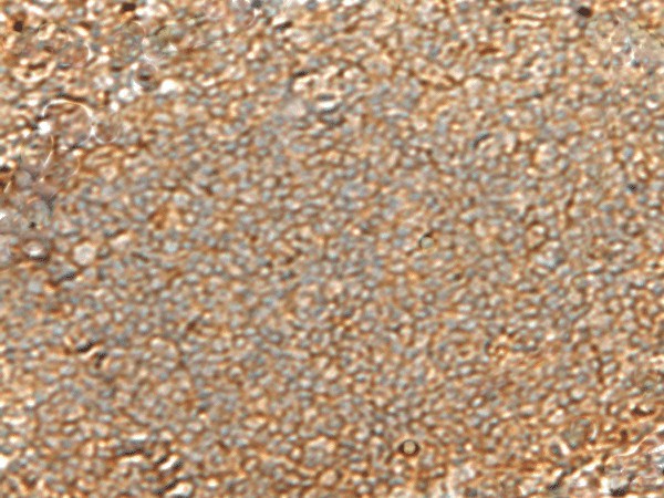 GNGT2 Polyclonal Antibody (E-AB-18073)
