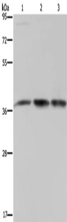 CAB39 Polyclonal Antibody (E-AB-13421)