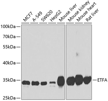 ETFA Polyclonal Antibody (E-AB-62733)