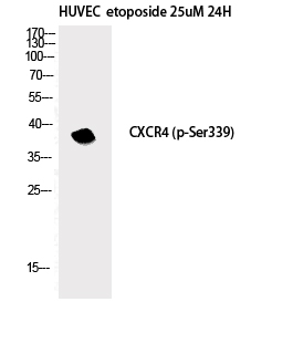 Phospho-CXCR4 (Ser339) Polyclonal Antibody (E-AB-21282)