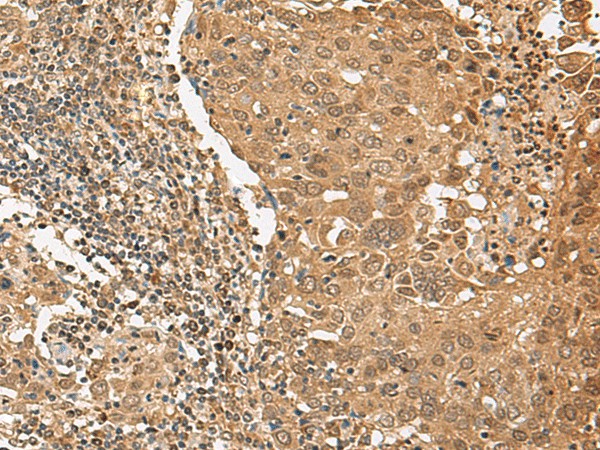 TIPRL Polyclonal Antibody (E-AB-52702)