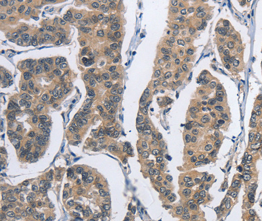 DSG2 Polyclonal Antibody (E-AB-11155)