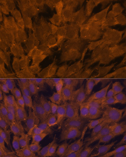 STAM2 Polyclonal Antibody (E-AB-61497)