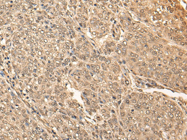 BRF2 Polyclonal Antibody (E-AB-18547)