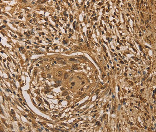 PRDM14 Polyclonal Antibody (E-AB-14628)